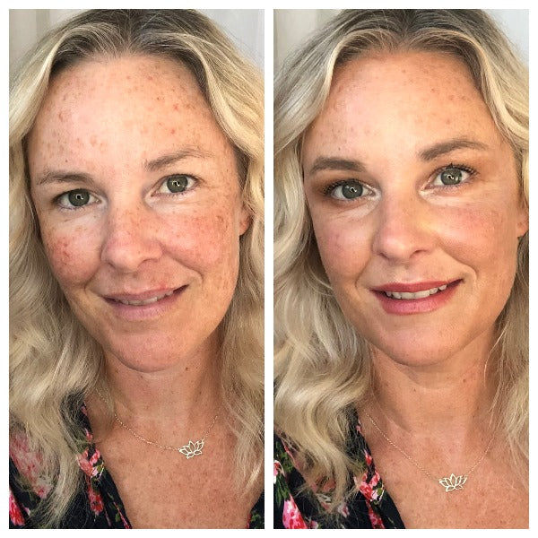 amanda_beforeandafter_kylies_mineralpowderfoundation