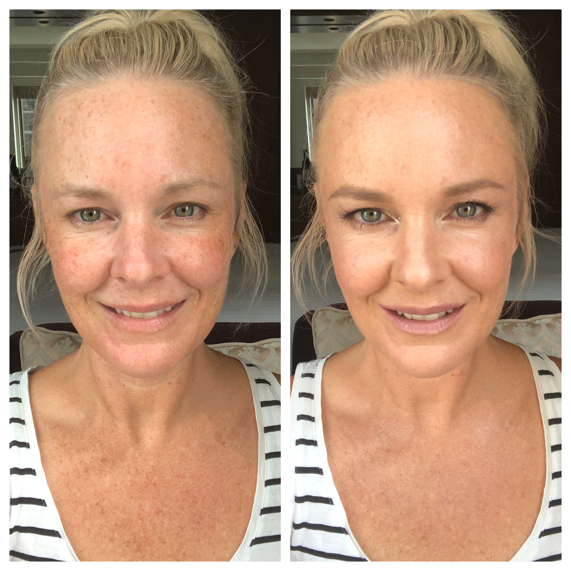 amanda_rageism_allday_foundation_beforeafter