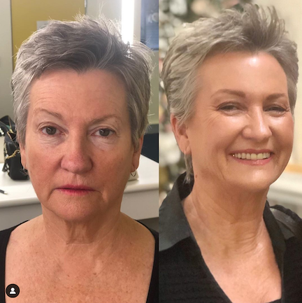 beforeafter-zoe-tvsn-rageism