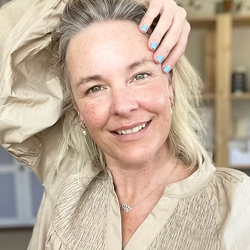 6 products that helped heal my sensitised skin