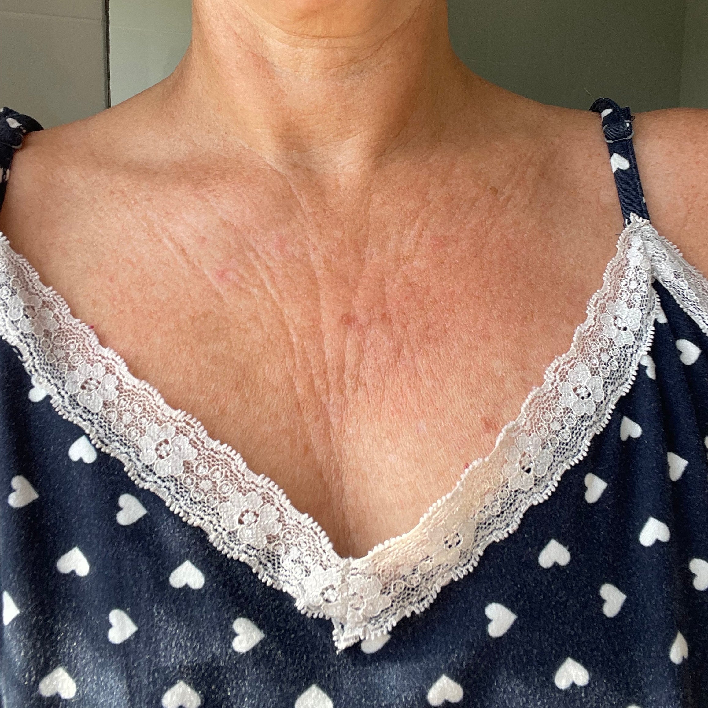 Wrinkles Schminkles Chest Patch