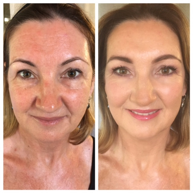 beforeandafter_photo_glyn