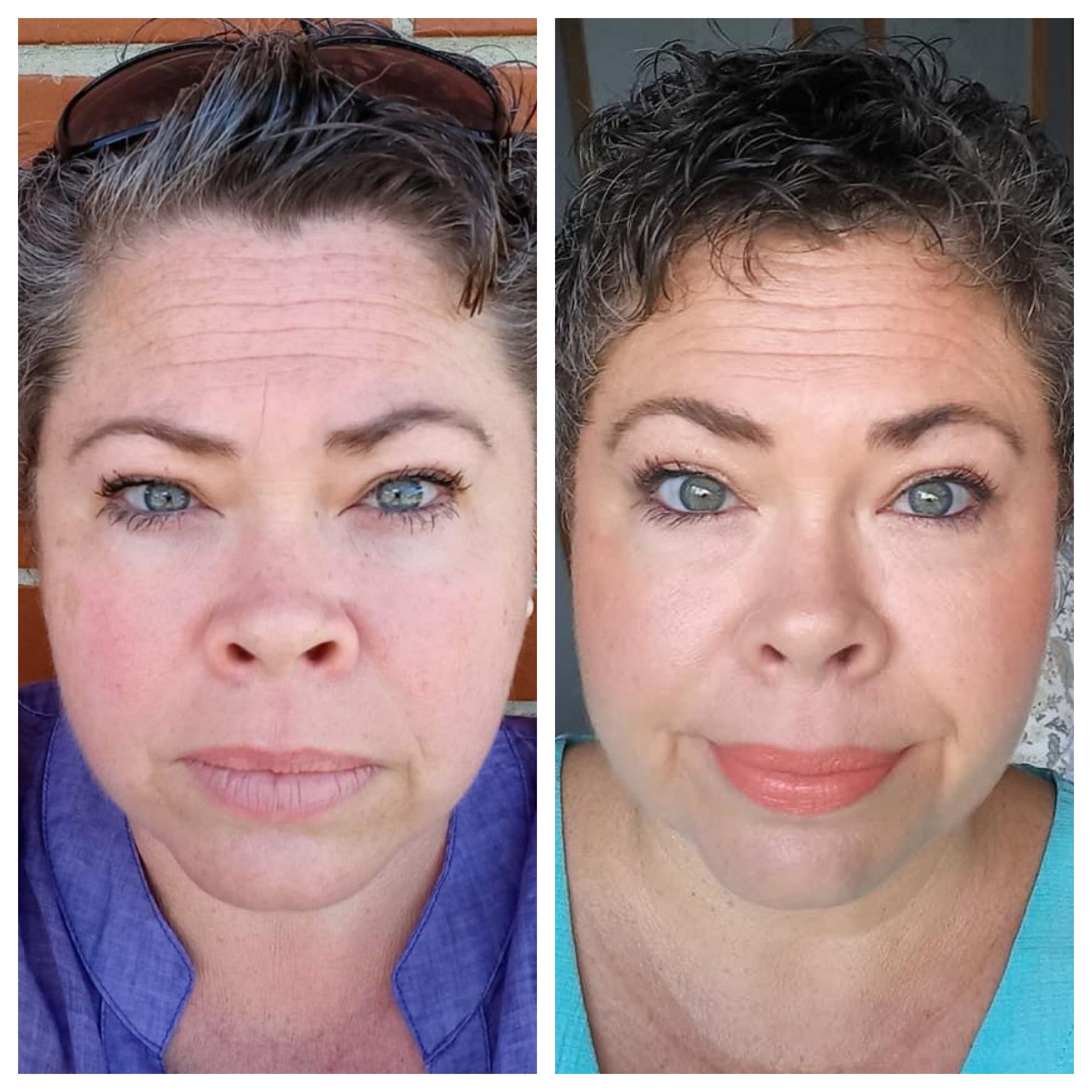 Before_After_over50_louise