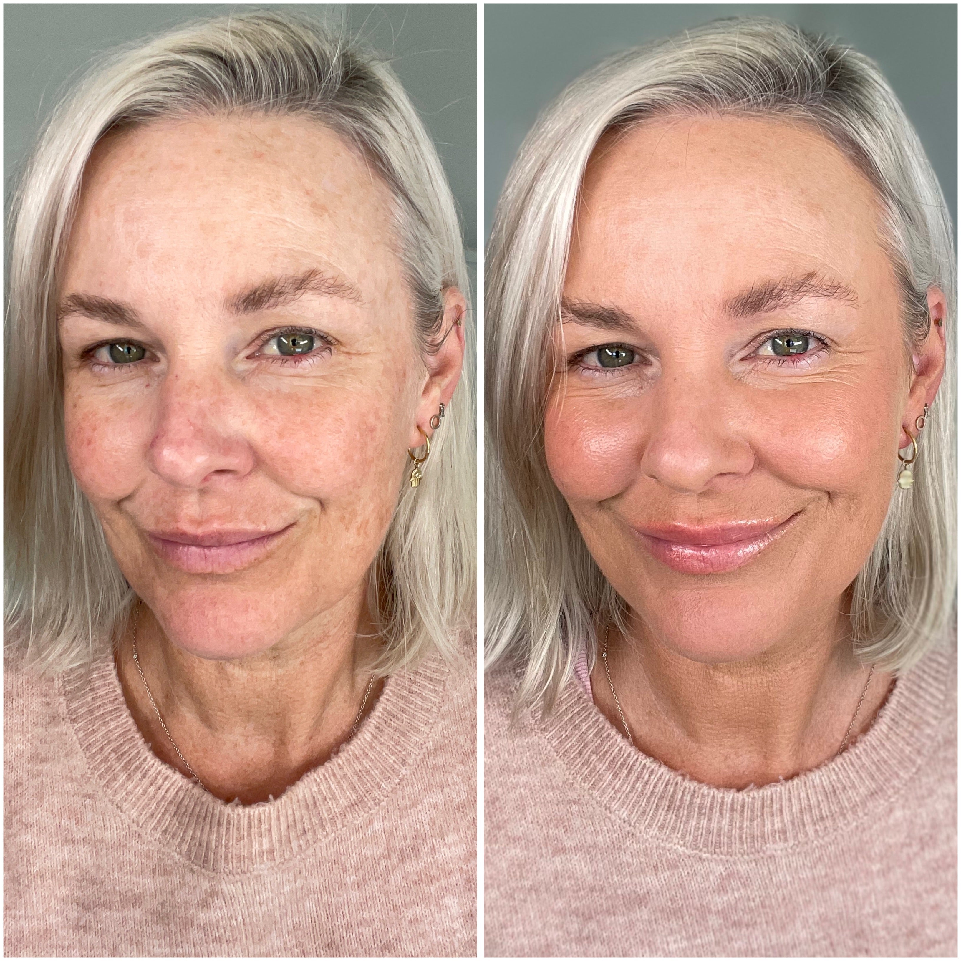 Amanda Before and After the Runway Room Complexion Lifting kit