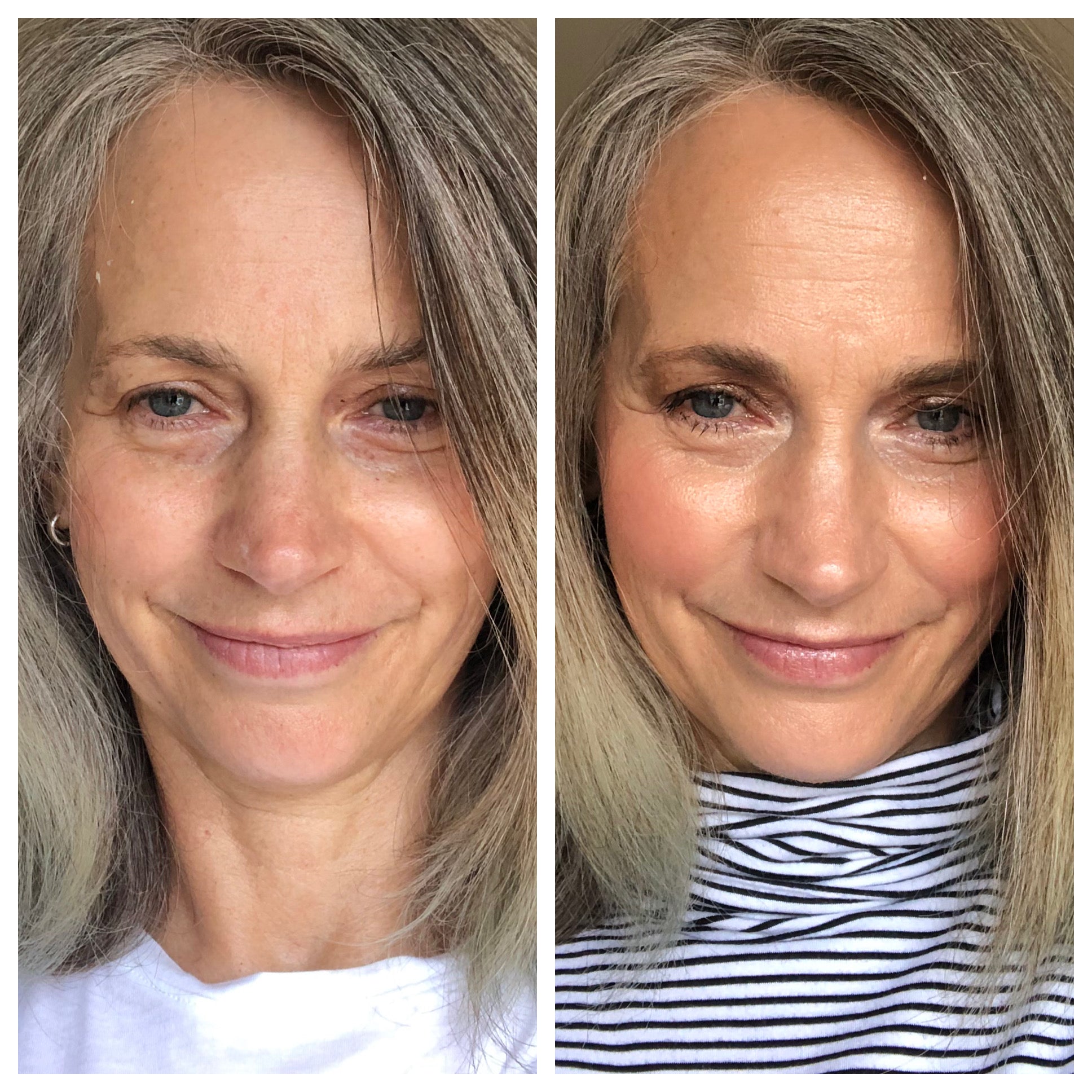 before_after_over40s_kerilee
