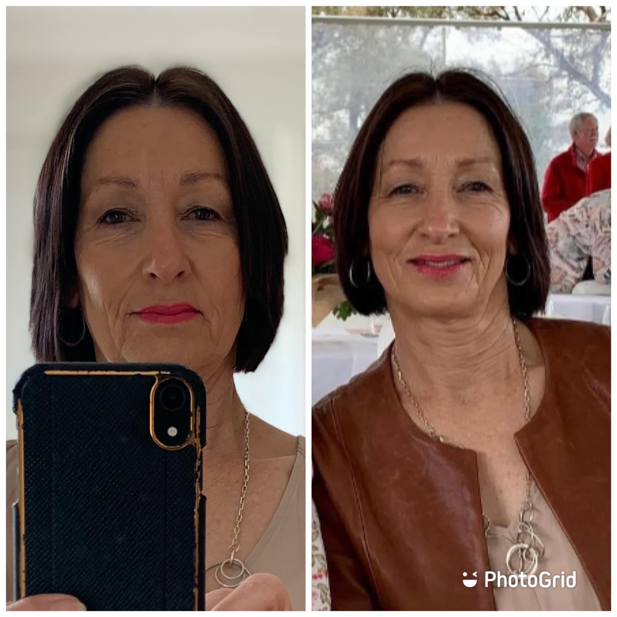 before_after_over50s_belinda_2