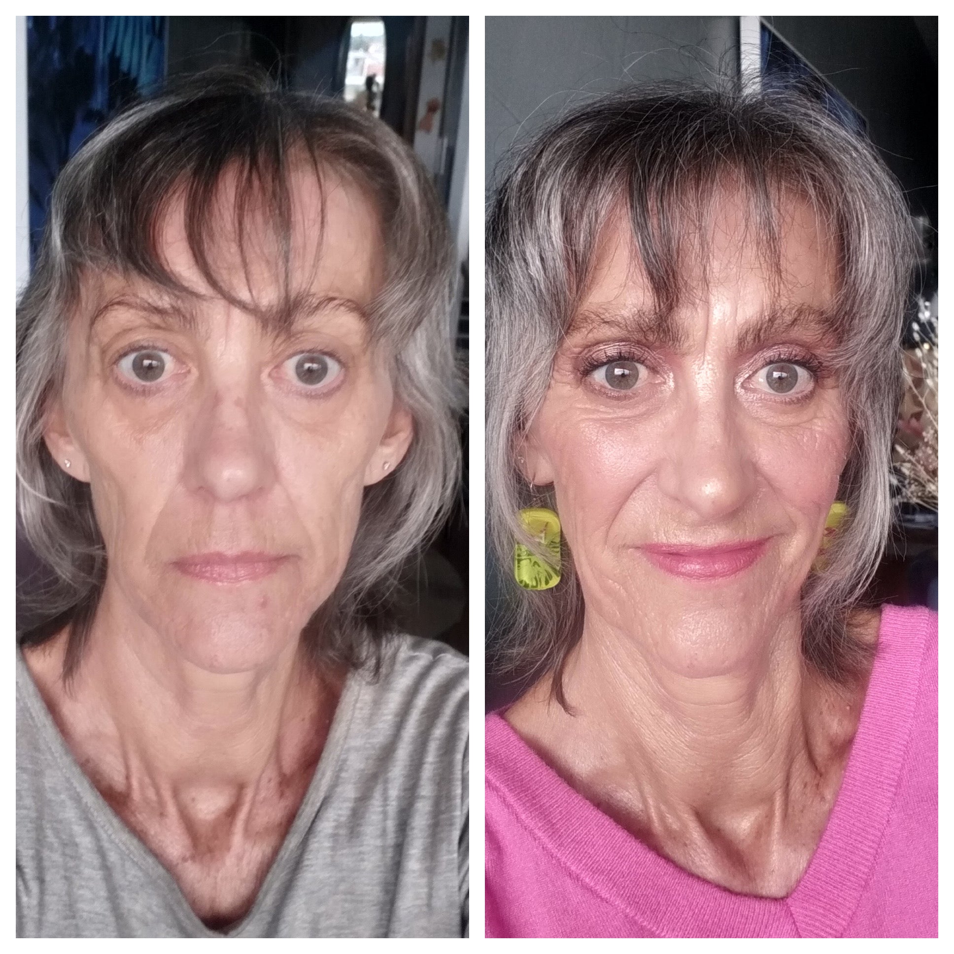 before_after_over60_karan