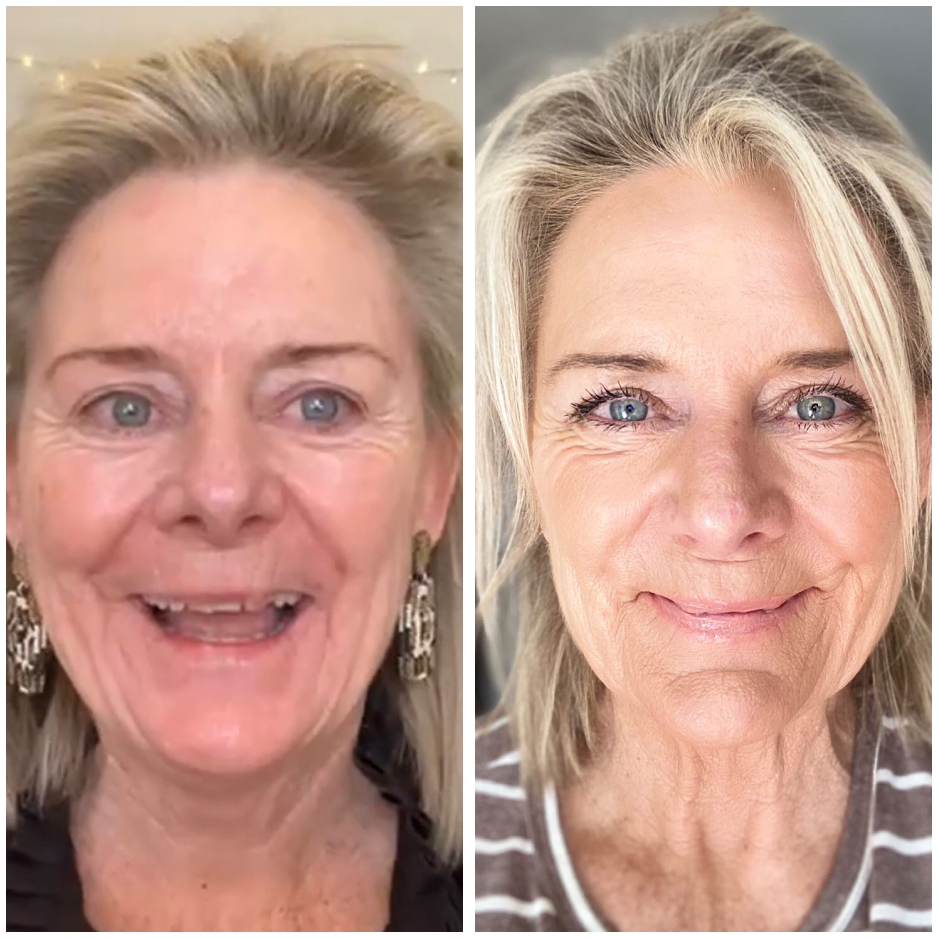 before_after_over60_maz