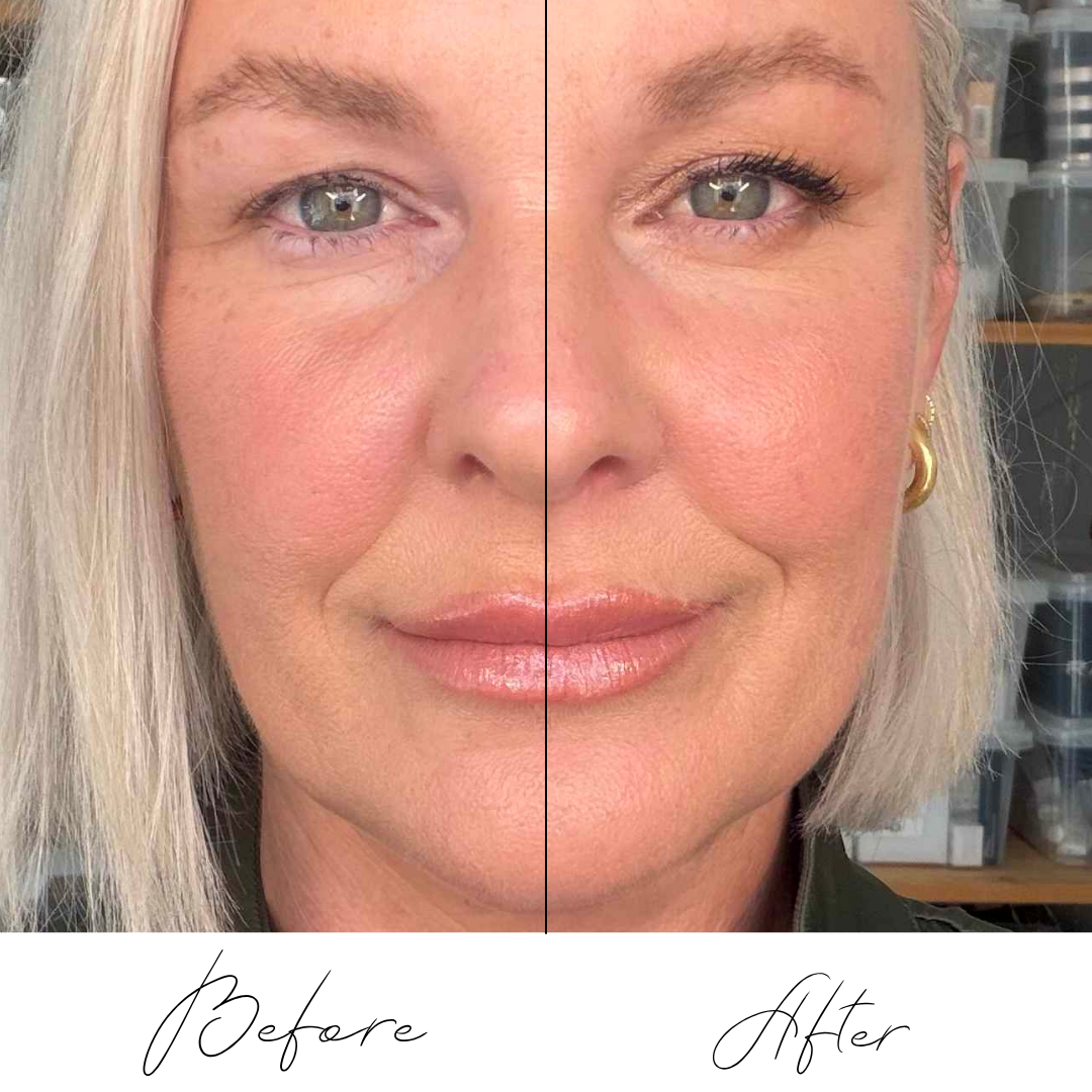 hooded_eyes_before_after