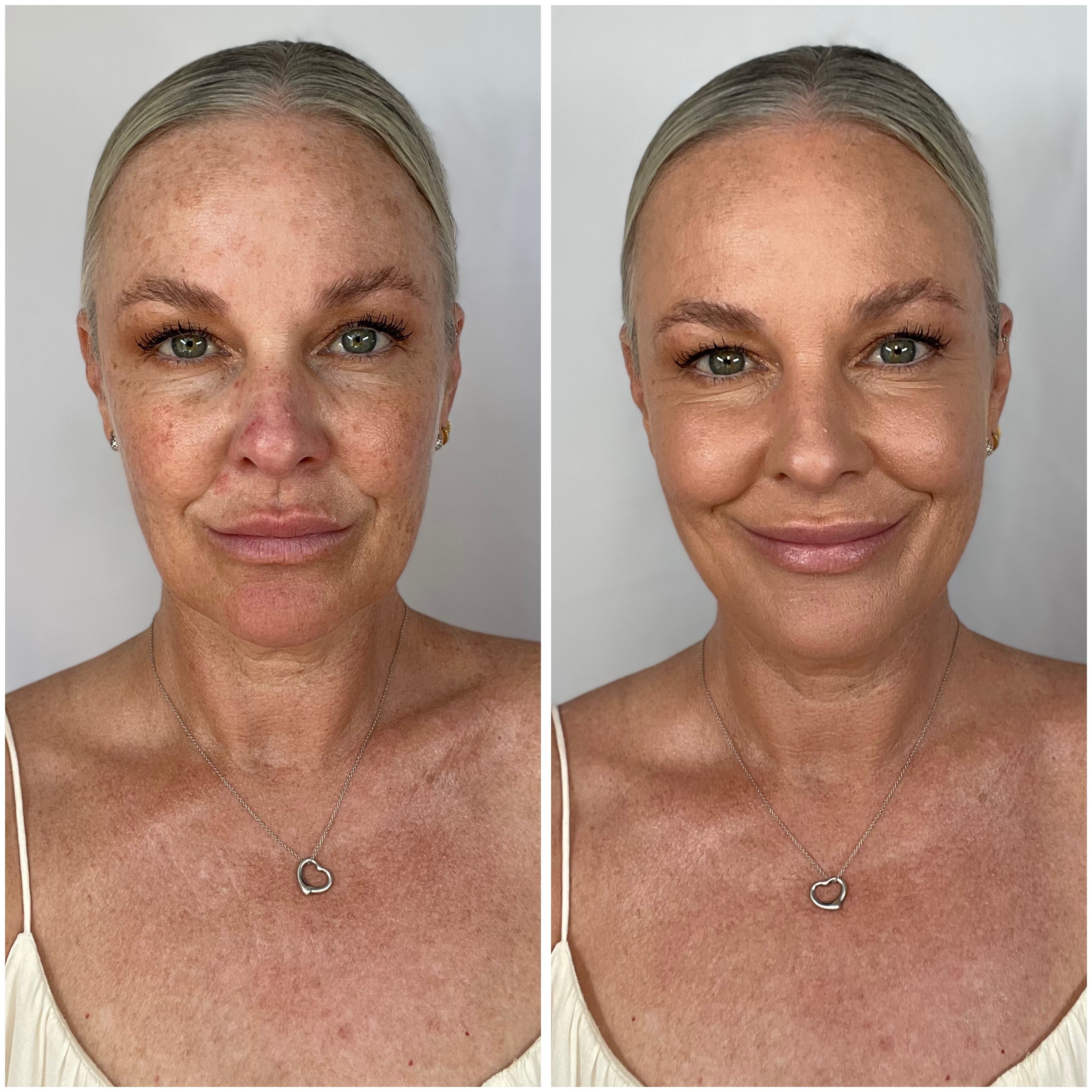 inclinic_activeglow_foundation